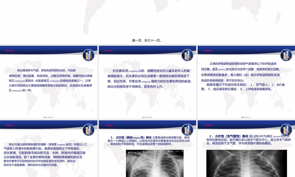 2022年医学专题—肺炎.ppt