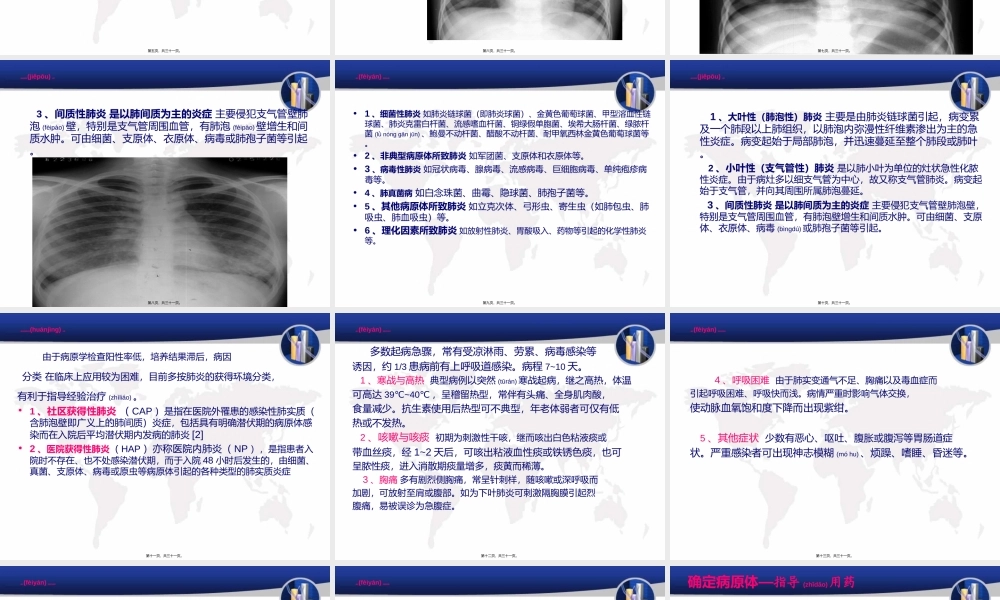 2022年医学专题—肺炎.ppt