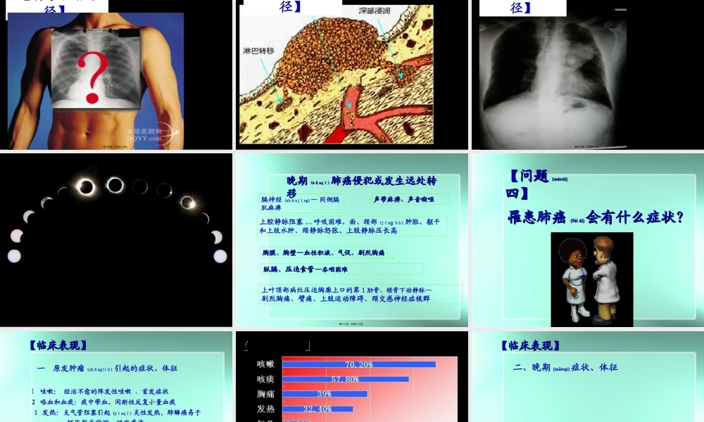 2022年医学专题—肺癌与希望.ppt