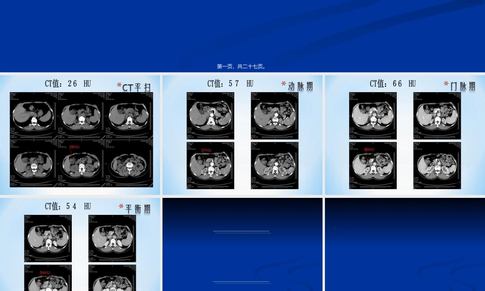 2022年医学专题—胆囊腺肌增生症.ppt