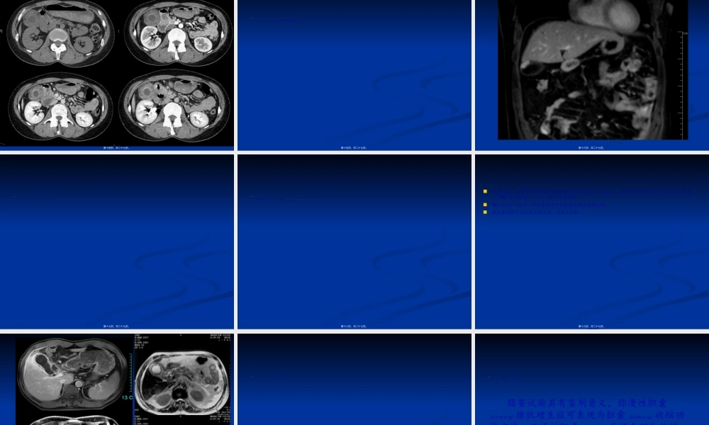 2022年医学专题—胆囊腺肌增生症.ppt
