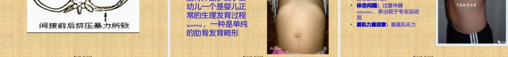 2022年医学专题—胸部的骨与关节.pptx