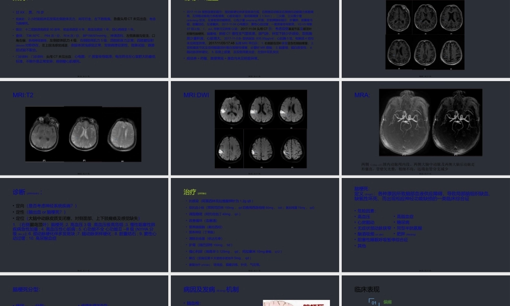 2022年医学专题—脑梗死.pptx
