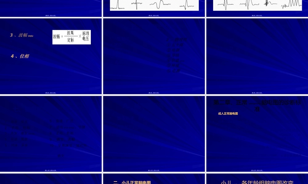2022年医学专题—脑电图基础知识幻灯片.ppt