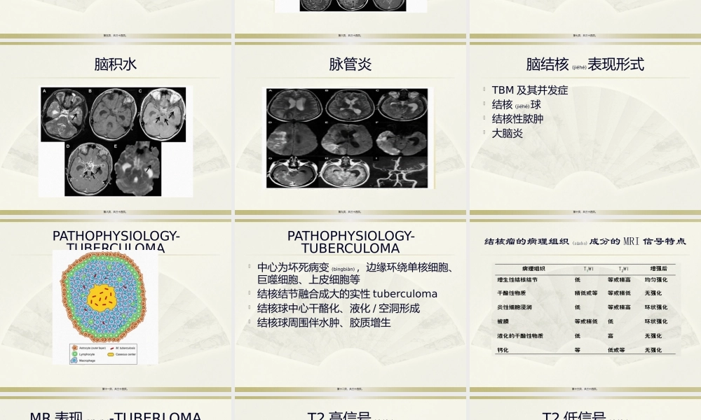 2022年医学专题—脑结核的影像学表现.pptx