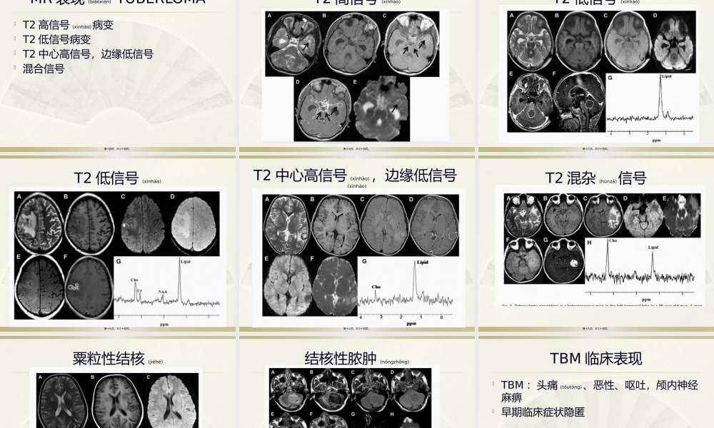 2022年医学专题—脑结核的影像学表现.pptx
