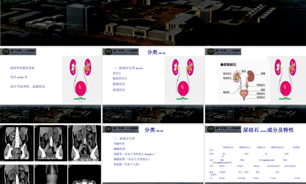 2022年医学专题—膀胱结石尿道结石.ppt