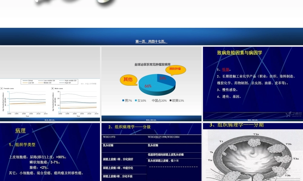 2022年医学专题—膀胱癌的诊治2018.ppt