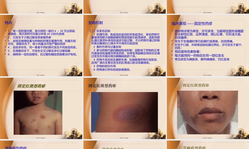 3、药疹--已讲.pptx