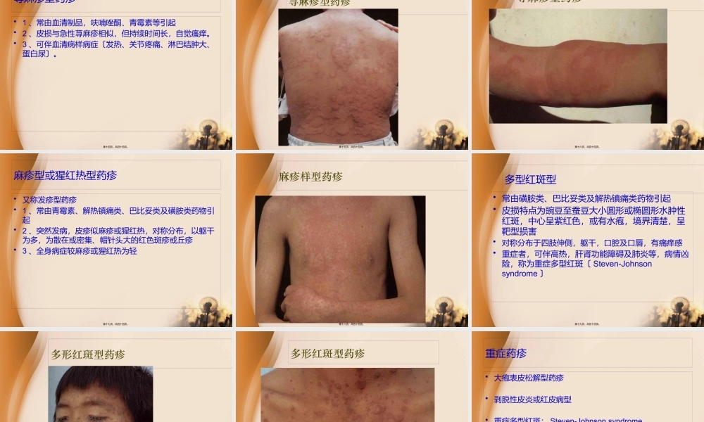 3、药疹--已讲.pptx