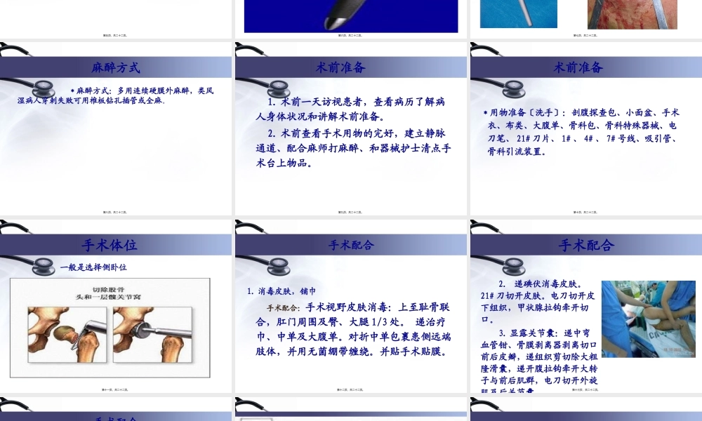 人工全髋关节置换术.pptx