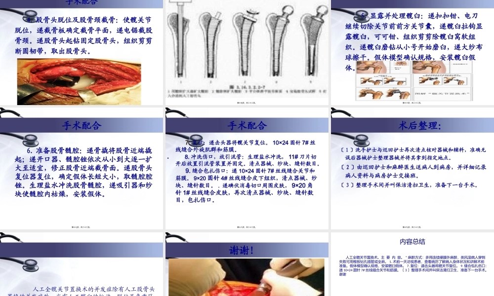 人工全髋关节置换术.pptx