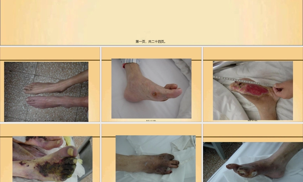 保护你的脚-416医院-张颖-2015-07-07.pptx