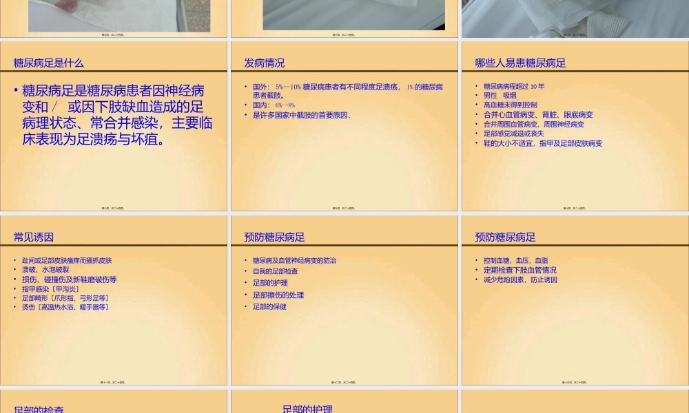 保护你的脚-416医院-张颖-2015-07-07.pptx