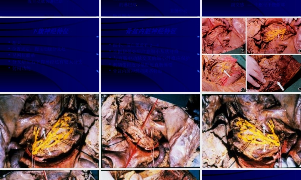 保留神经直肠癌根治术讲解.pptx