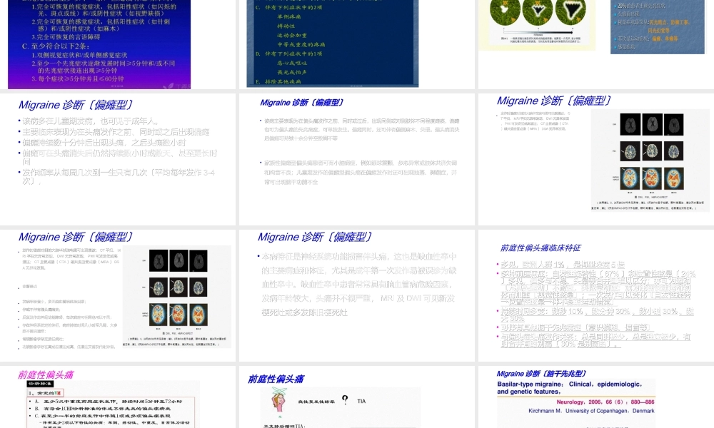 偏头痛migraine.ppt