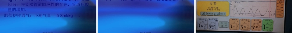 儿科呼吸机应用.pptx