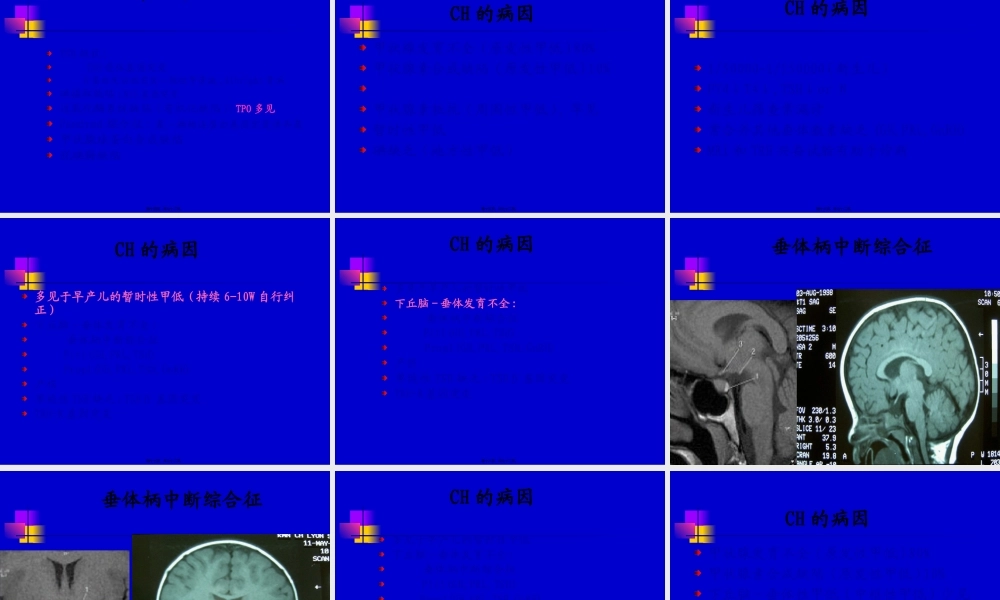 儿童甲低和甲亢yjs.pptx