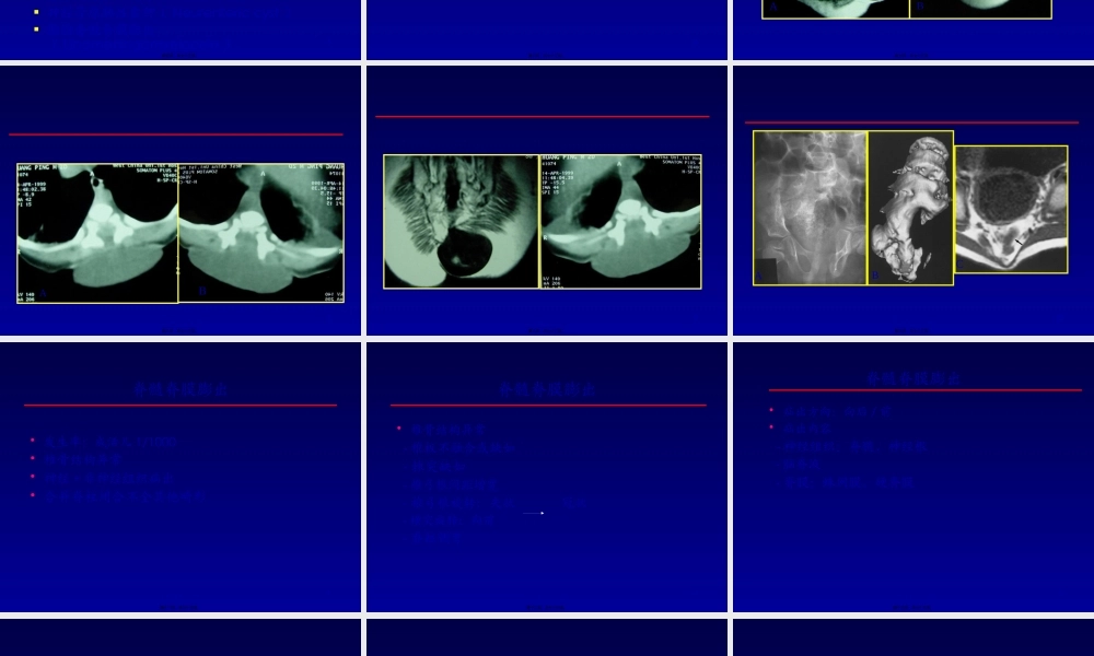先天性脊柱闭合不全性病变MRI.pptx