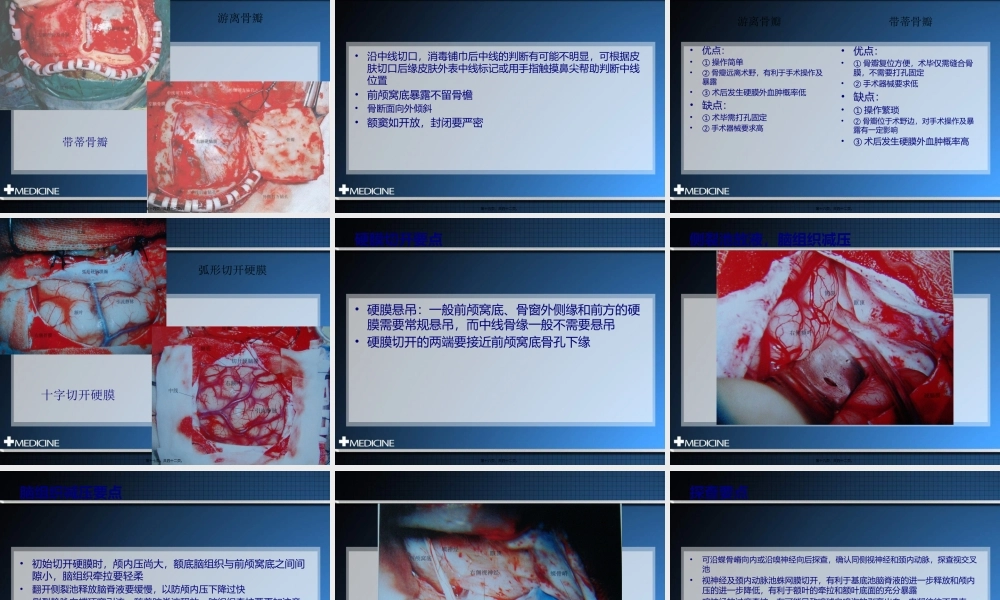 冠切开颅额下入路.pptx