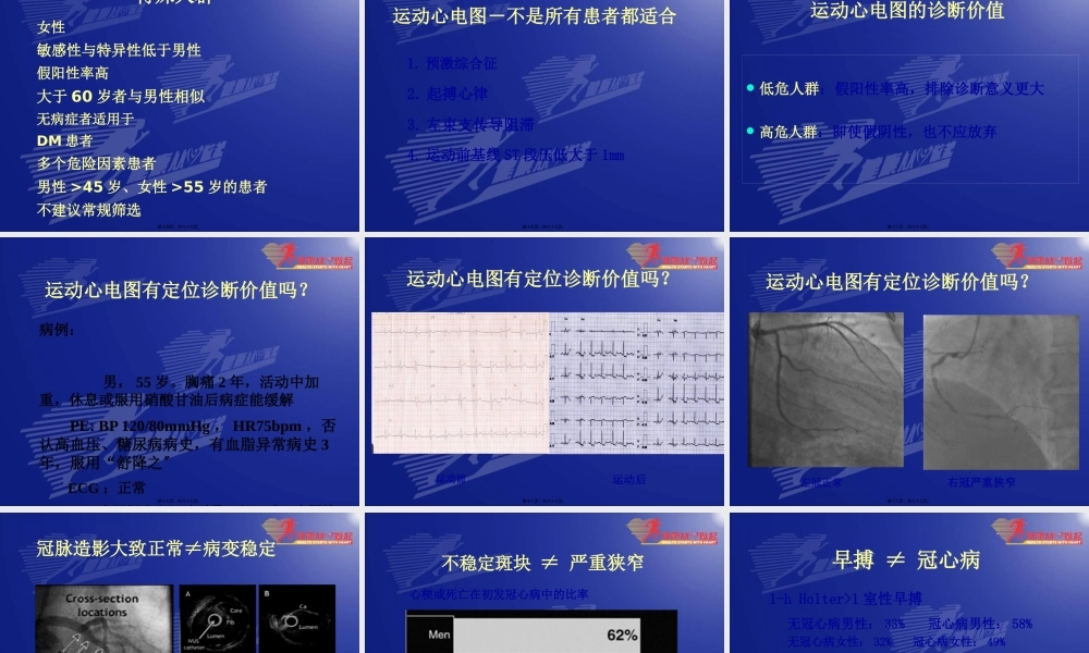 冠心病诊治中的常见误区-庞文跃.pptx