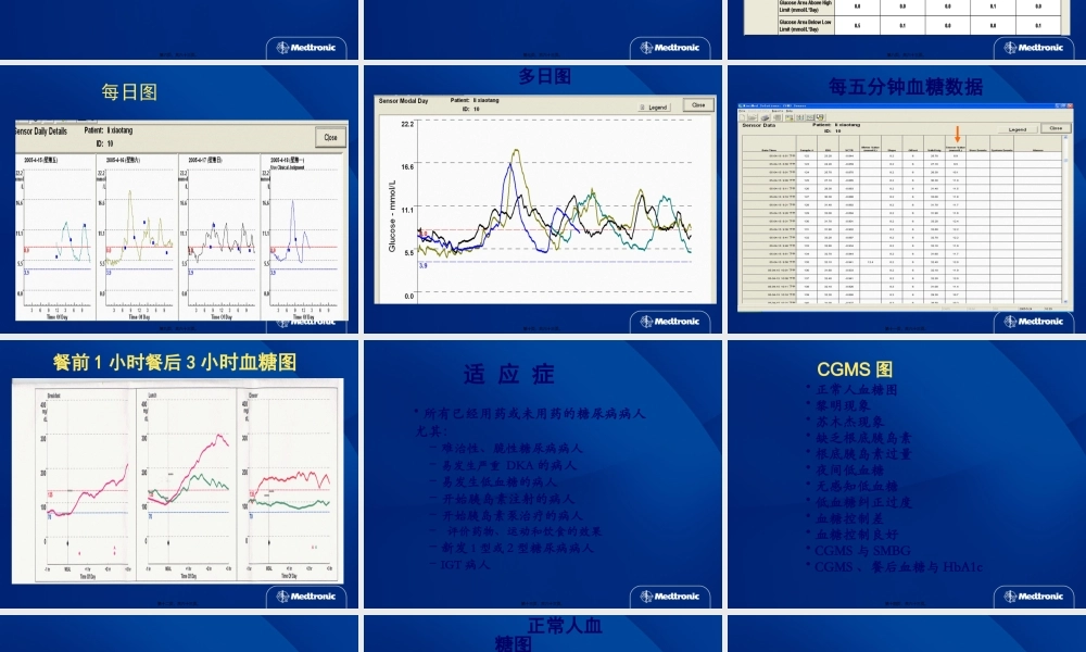 动态血糖仪及未来展望.pptx