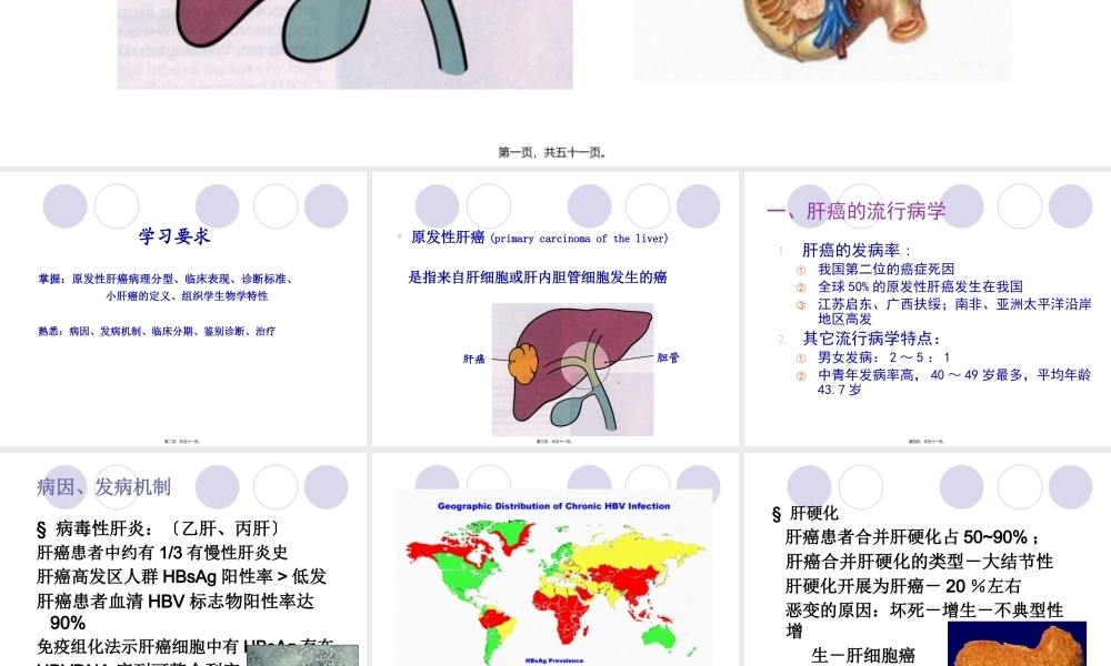 原发性肝癌-俞.pptx