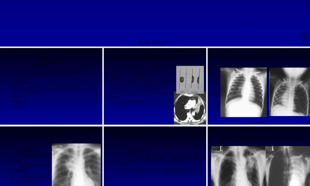 呼吸系统基本病变3.pptx
