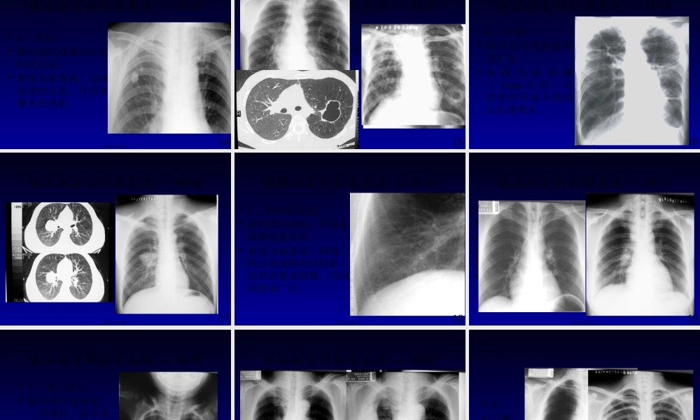 呼吸系统基本病变3.pptx
