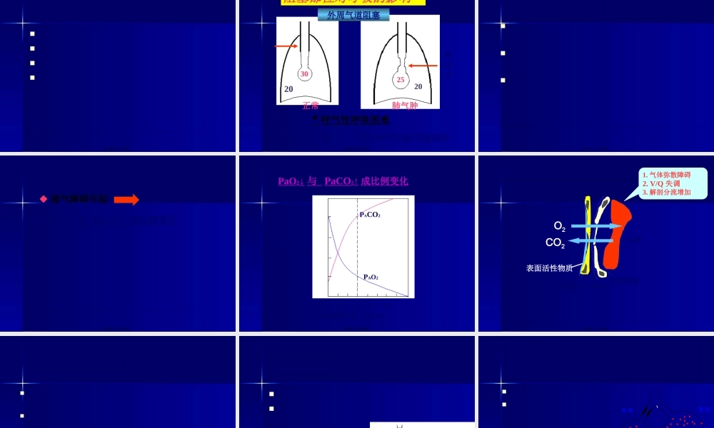 呼吸衰竭ARDS.pptx