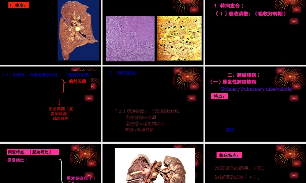 大叶性肺炎与小叶性肺炎的区别.pptx
