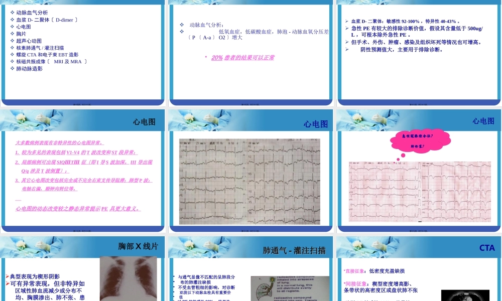 大面积肺栓塞与急性右心功能不全.pptx