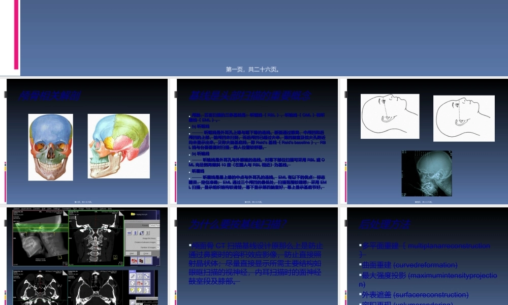 头部外伤CT检查规范.ppt