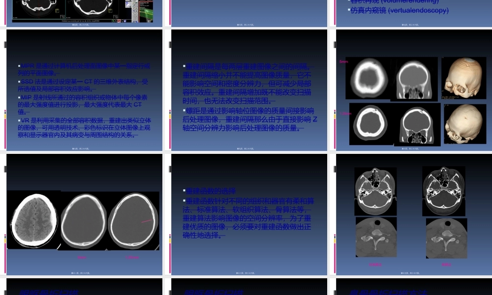头部外伤CT检查规范.ppt