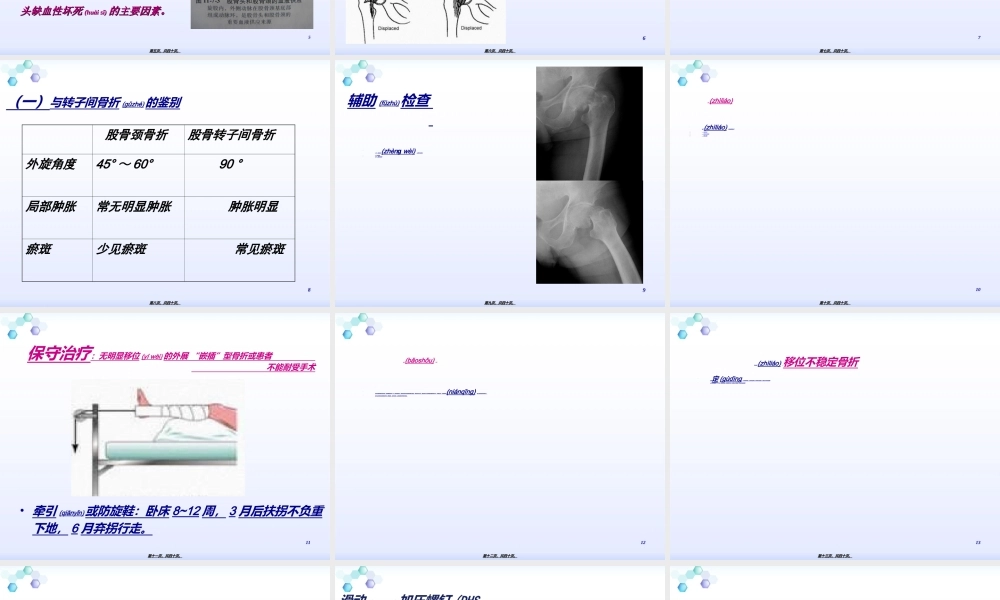 2022年医学专题—股骨颈骨折骨一科(1).ppt