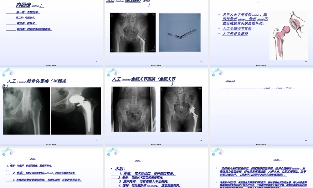 2022年医学专题—股骨颈骨折骨一科(1).ppt