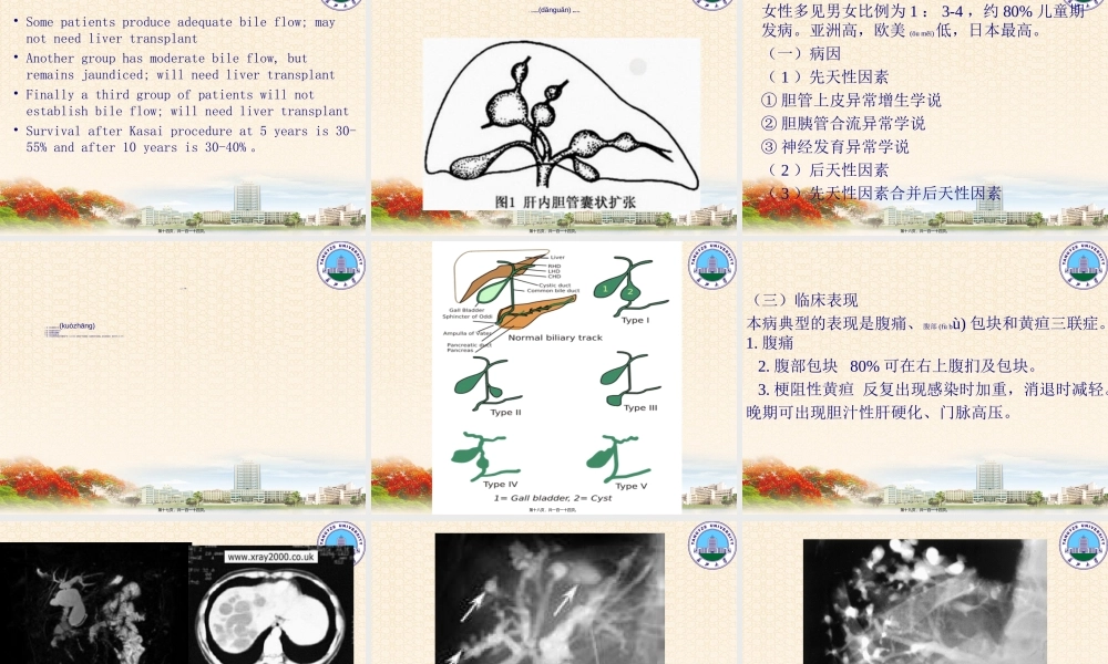 2022年医学专题—胆道闭锁阻塞性黄疸胆汁淤积性肝硬化Bridgingfibrosisin-长江大学(1).ppt