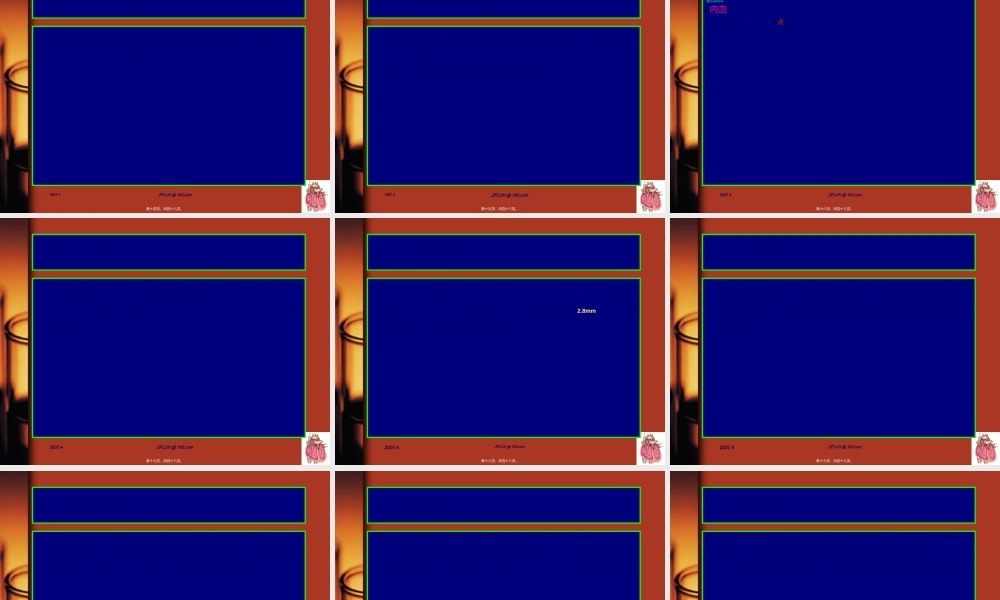 2022年医学专题—冠脉支架内血栓的防治策略.ppt