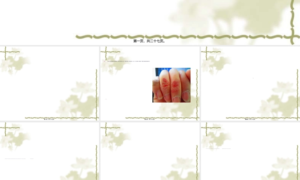 2022年医学专题—冷伤.ppt