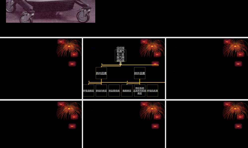 2022年医学专题—呼吸衰竭患者的监护.ppt