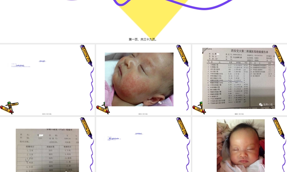 2022年医学专题—儿童过敏病例分享(1).ppt