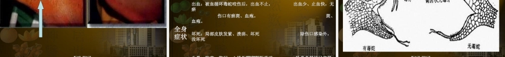 2022年医学专题—常见毒蛇的识别及处理(1).ppt