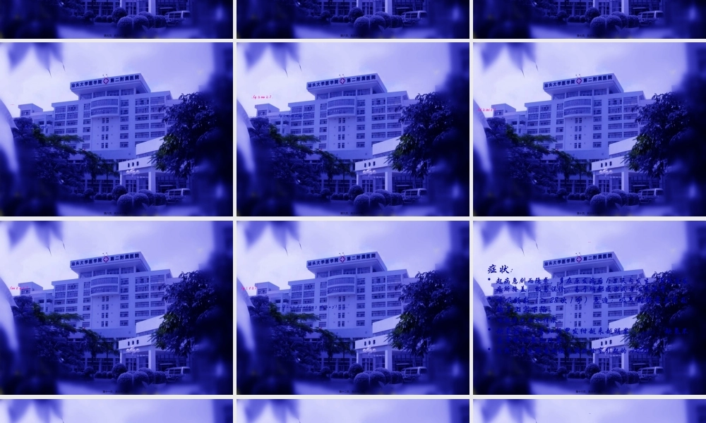 2022年医学专题—急性呼吸窘迫综合(1).ppt