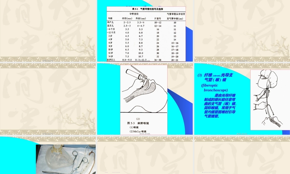 2022年医学专题—气管插管术及并发症防治(1).ppt