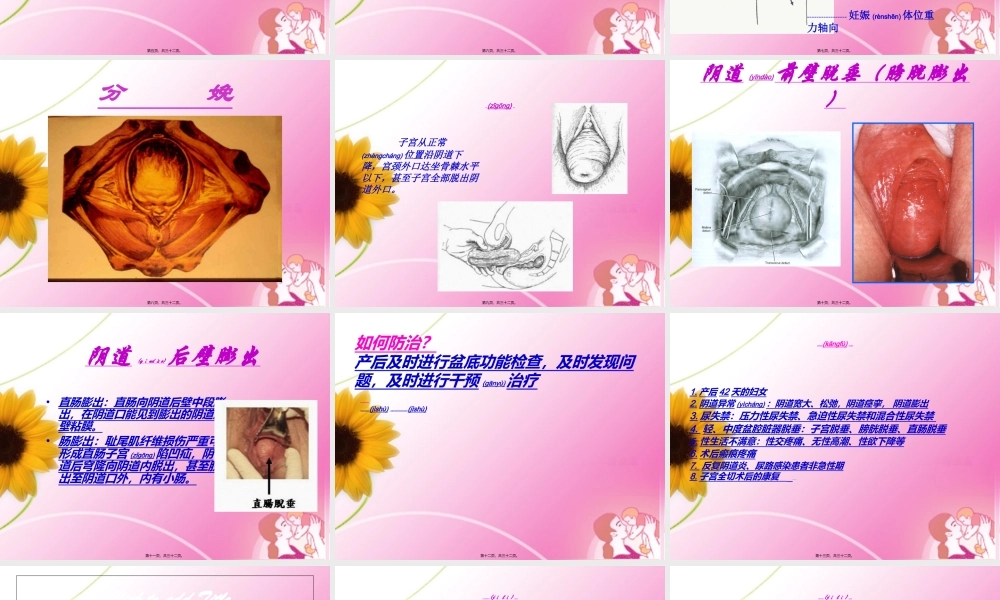 2022年医学专题—盆底功能康复(1).ppt