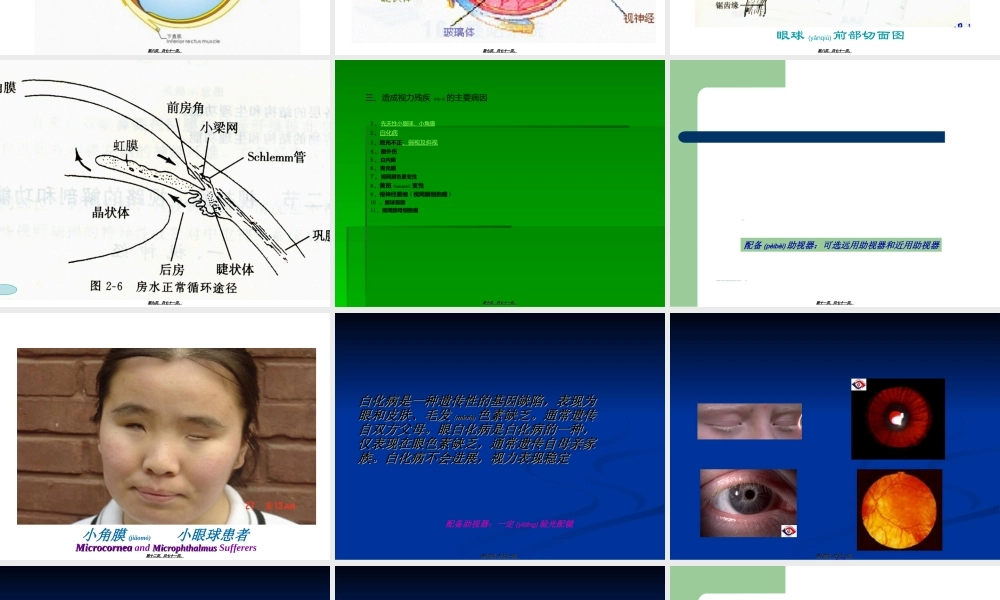 2022年医学专题—眼科知识与低视力常识(1).ppt