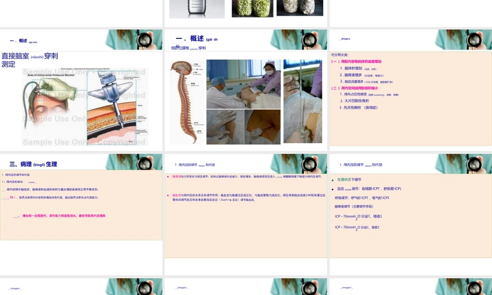 2022年医学专题—第十二章-第一节-颅内压增高(1).ppt