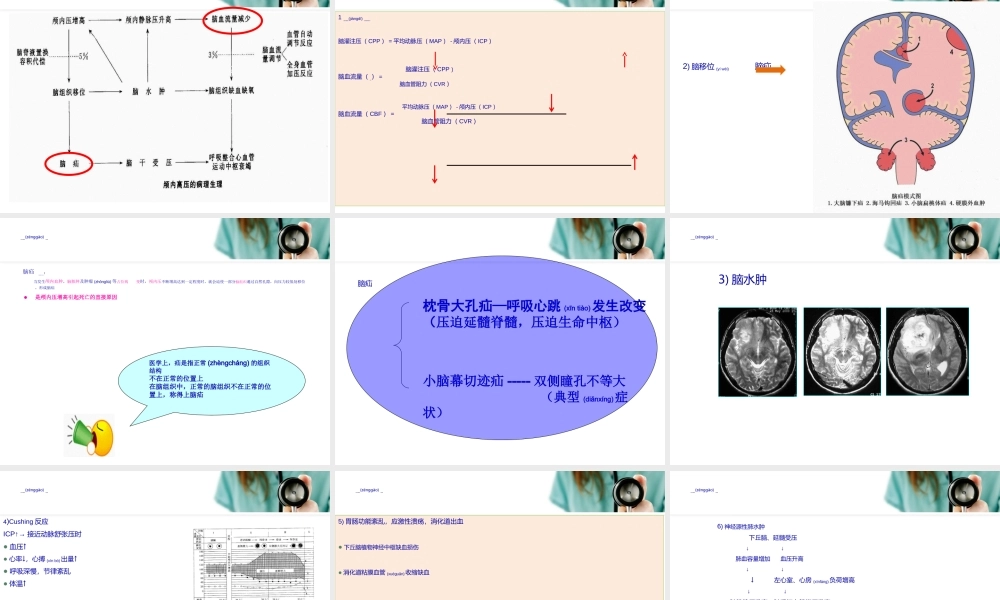2022年医学专题—第十二章-第一节-颅内压增高(1).ppt
