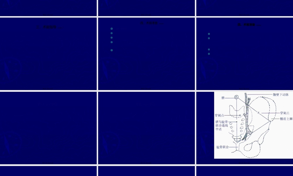 2022年医学专题—腹腔穿刺术-(1)(1).ppt