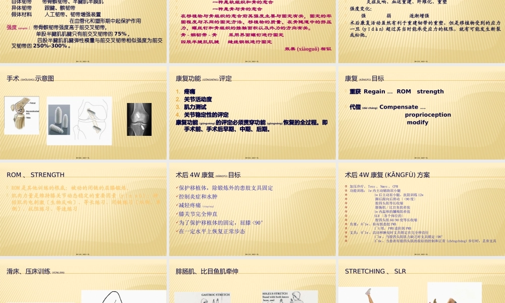 2022年医学专题—ACL损伤与康复.pptx